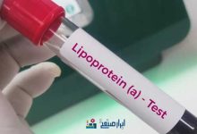 شکست داروی آزمایشی نوارتیس